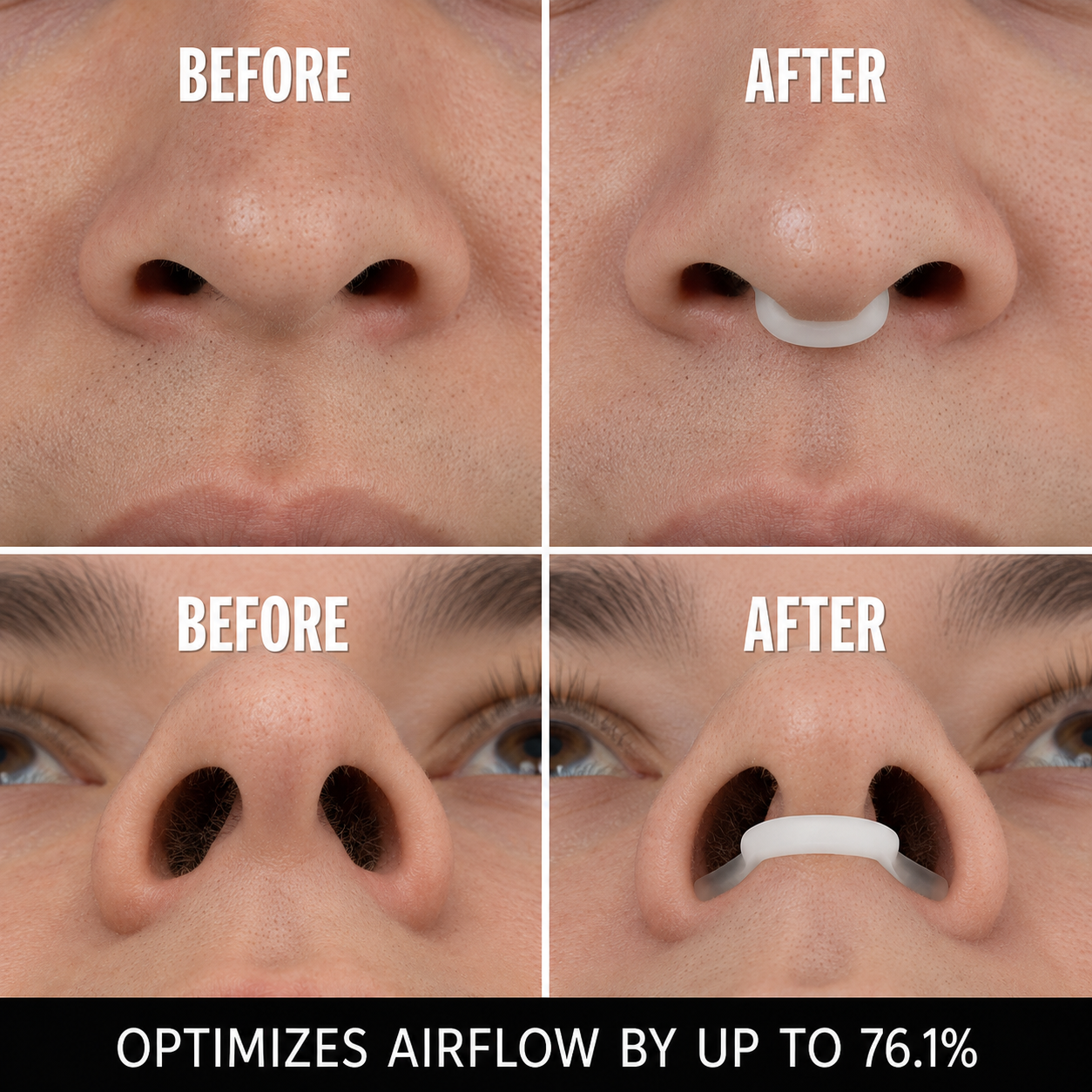 Nasal dilator benefits for sleeping
